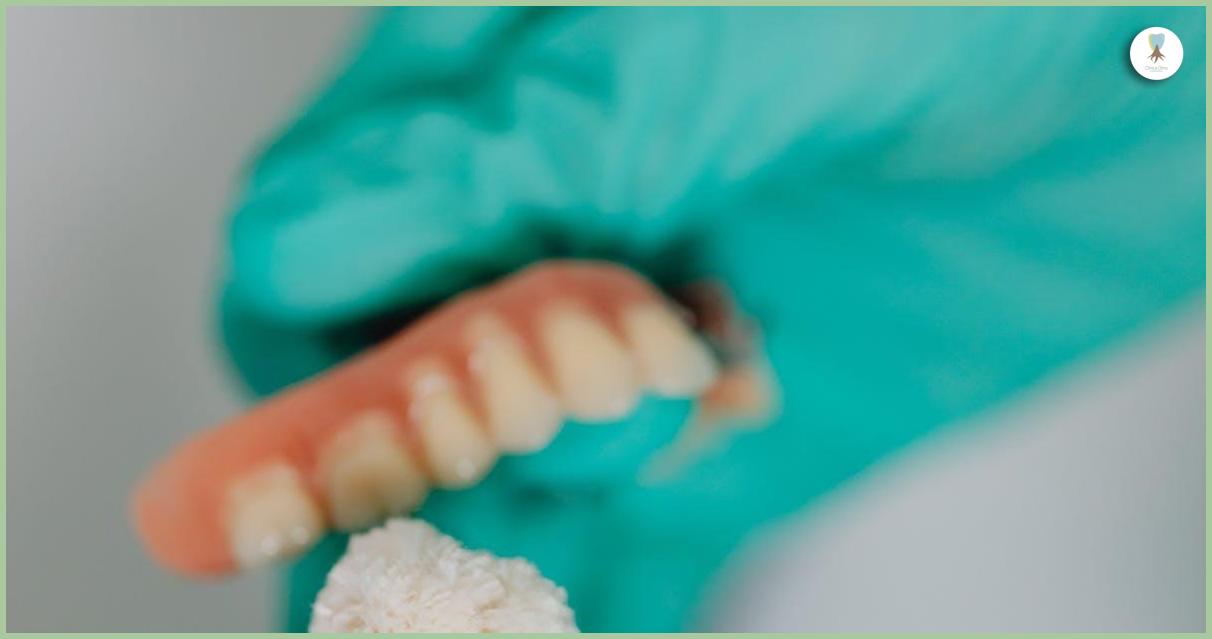 Implantes dentales vs. prótesis removibles: ¿cuál es la mejor opción para ti?